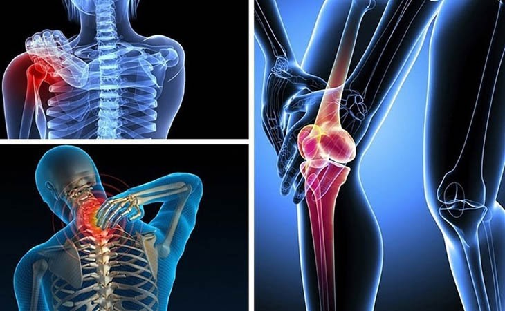 Cách phòng chống thoái hóa khớp nếu bạn bị béo phì